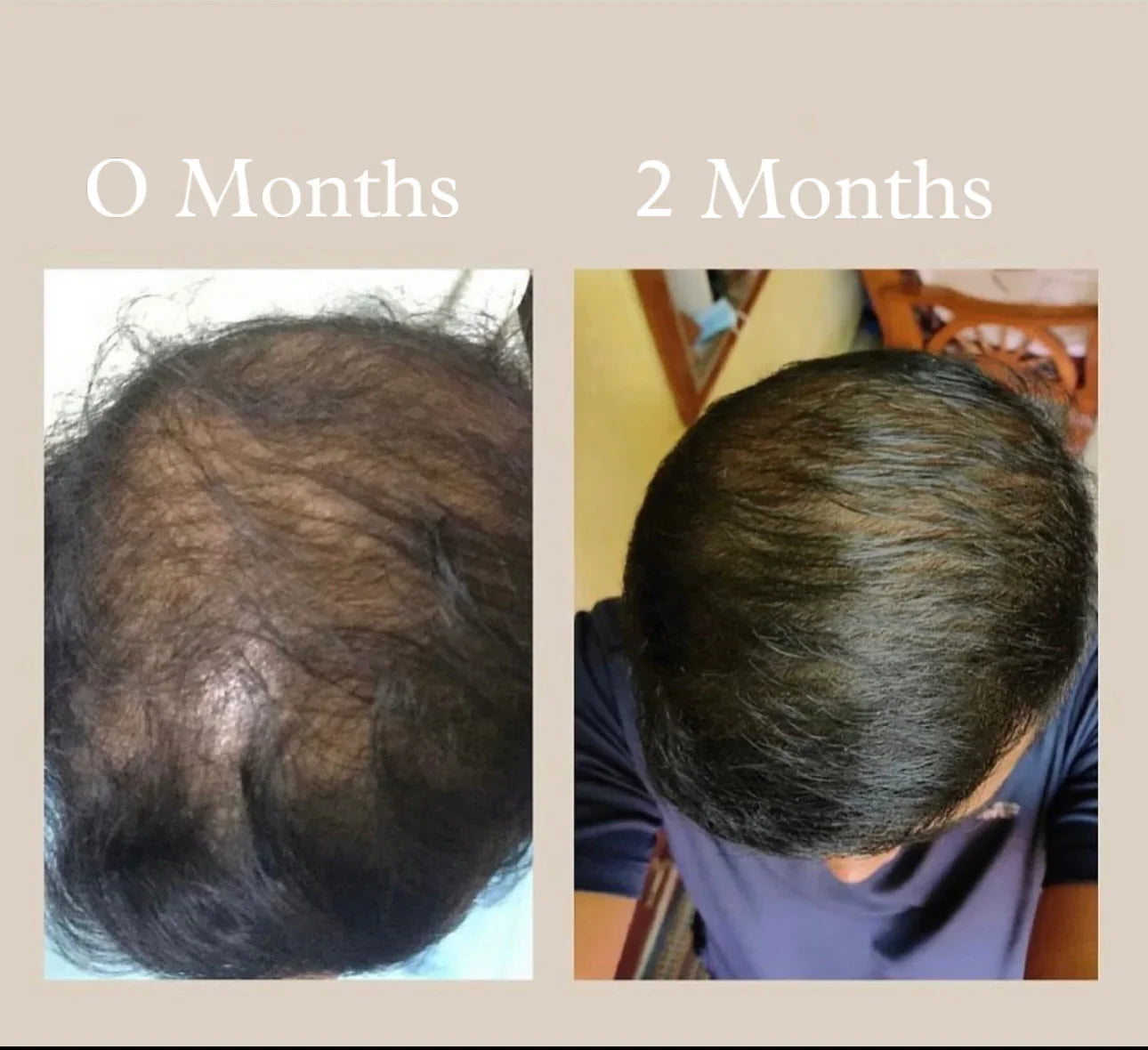 Adivasi Herbal Hair Oil -Buy 1 Get 1 Free🎁